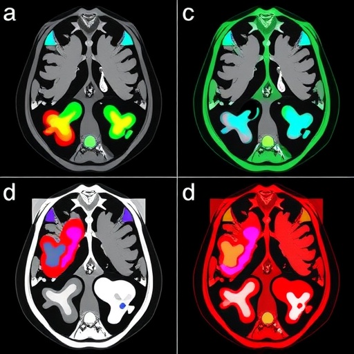 Multi-domain collaborative learning improves medical image segmentation via MDCL-UNet