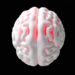 New 3D pediatric brain phantom validated for CT neuroimaging research