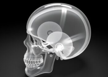 New 3D printed cranioplasty template enables posterior fossa craniotomy in preclinical validation