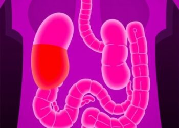 New model predicts gastrointestinal bleeding risk in childhood IgA vasculitis