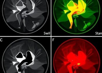 New multimodal graph approach classifies esophageal motility disorders