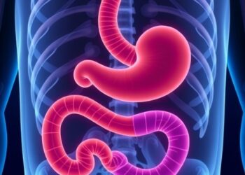 New nomograms predict survival and recurrence after gastric cancer surgery