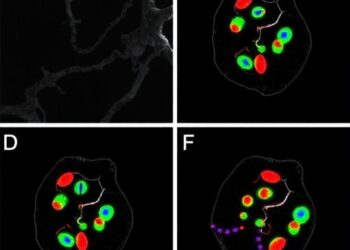 Novel AGXT2-PYCR3 macrophage subtypes identified in fatty liver disease