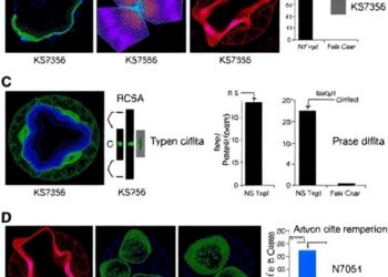 Novel kynureninase inhibitor KS79356 slows triple-negative breast cancer progression