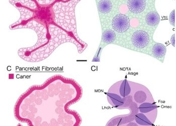 Organoid co-cultures expose epithelial and fibroblast diversity in pancreatic cancer and pancreatitis