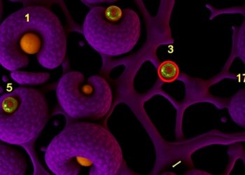 Pancreatic cancer organoids uncover genes driving chemotherapy resistance