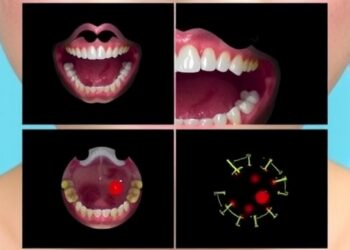 Pediatric Behçet’s Disease Marked by Recurring Oral and Genital Ulcers