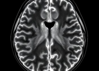 Preliminary diffusion tensor MRI study of the normal fetal lung