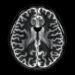 Preliminary diffusion tensor MRI study of the normal fetal lung