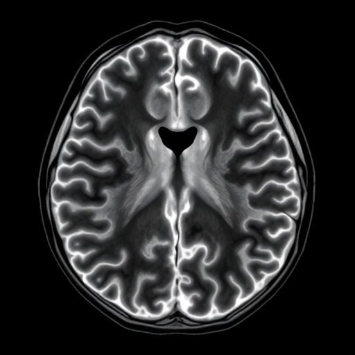 Preliminary diffusion tensor MRI study of the normal fetal lung