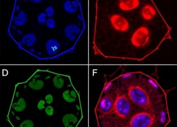 Propranolol stereoisomers show distinct effects in infantile hemangioma cells