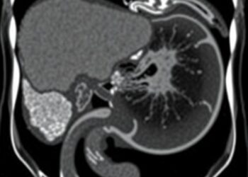 Rare Case: Sequential Pancreatic Neuroendocrine Tumor and Adenocarcinoma Reported