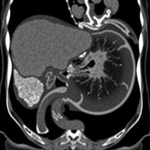 Rare Case: Sequential Pancreatic Neuroendocrine Tumor and Adenocarcinoma Reported