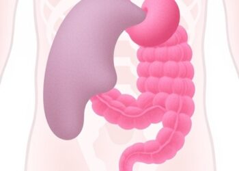 Risk factors for multicentric lower genital tract intraepithelial neoplasia revealed