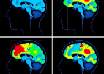 Scoping review maps cortical activation during swallowing tasks using fNIRS