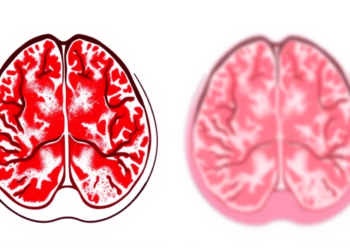 When Tumors Return May Predict Survival in Metastatic GIST