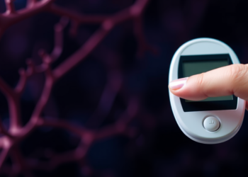 Early-Onset Type 2 Diabetes Carries a Heavier Microvascular Burden at Younger Ages