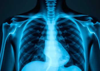 AI Reads Chest X-Rays Well in the Lab, but a New Review Warns the Clinic Is Another Story
