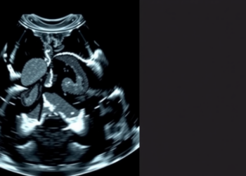 AI Ultrasound Model Learns When Not to Decide, Deferring Hard Lymph Node Cases