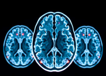 Lightweight AI Network Reads Brain Scans to Spot Alzheimer’s and Tumors With Striking Accuracy