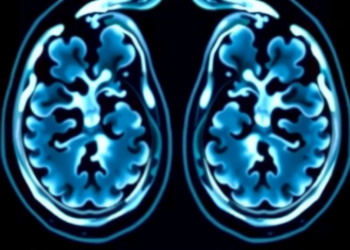 Children With Chronic Diseases May Accumulate Surprisingly High Radiation Doses From Medical Imaging