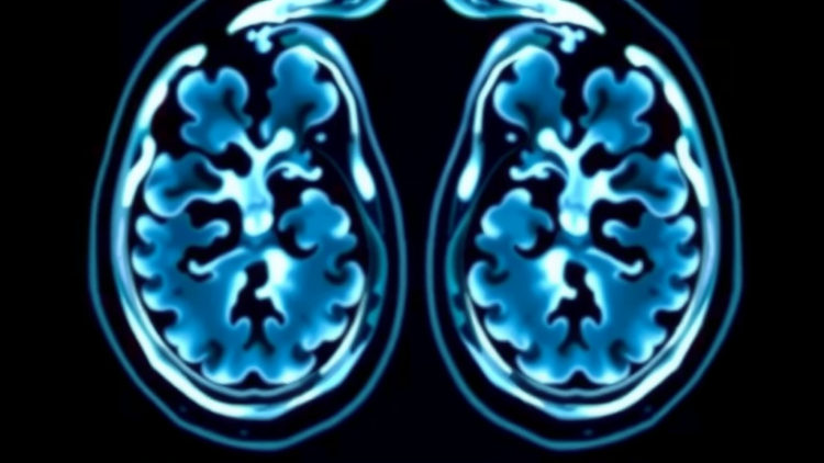 Children With Chronic Diseases May Accumulate Surprisingly High Radiation Doses From Medical Imaging