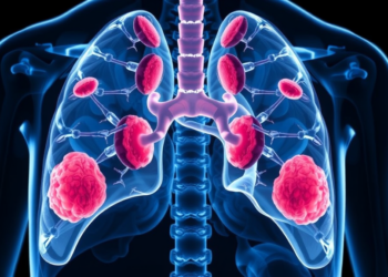 Lab-Grown Tumours and Digital Twins Bring Precision Therapy to Oesophageal Cancer