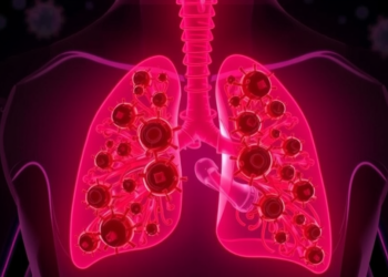 Common Childhood Virus Triggered Life-Threatening Lung Failure in Adult Patient