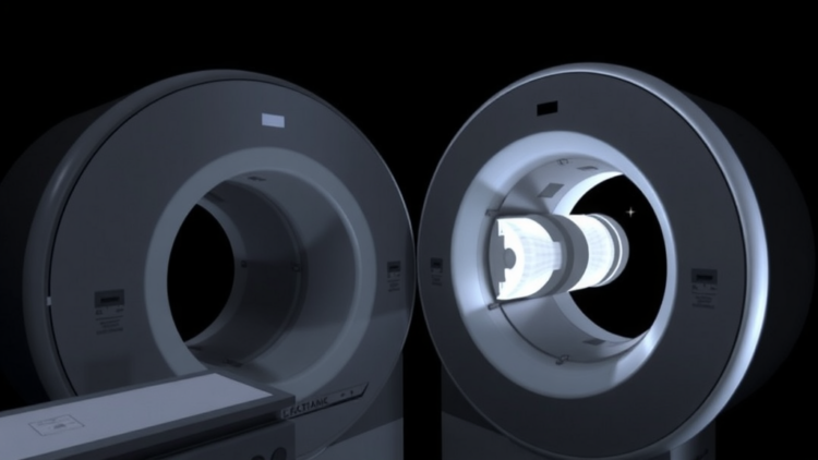 Angular Tube Current Modulation Cuts CBCT Radiation Dose Without Sacrificing Image Quality