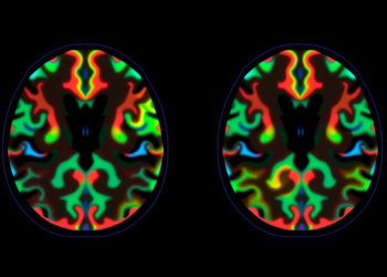 APOE4 Splits Alzheimer’s Into Two Neurochemical Diseases, PET Imaging Study Reveals