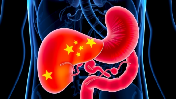 New 2025 Chinese Guidelines Redefine How Colorectal Cancer Liver Metastases Are Diagnosed and Treated
