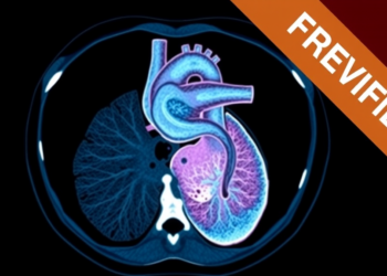 AI Matches Human Experts in CT Analysis for Heart Valve Planning