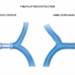 Efficacy of venous coupler versus hand-sewn venous anastomosis in free-flap reconstruction: a single-centre randomized controlled trial