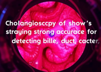 Cholangioscopy Shows Strong Accuracy for Detecting Bile Duct Cancer