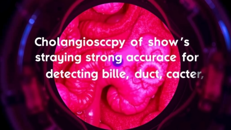 Cholangioscopy Shows Strong Accuracy for Detecting Bile Duct Cancer