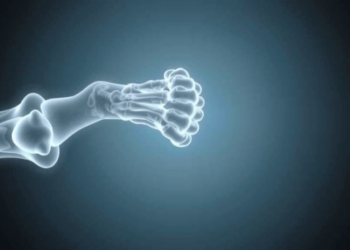 Soy Compound Genistein Shows Promise Against Diabetes-Linked Bone Loss