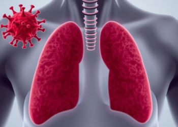 Ukraine’s Drug-Resistant Tuberculosis Epidemic Is Driven by a Handful of Dominant Clones