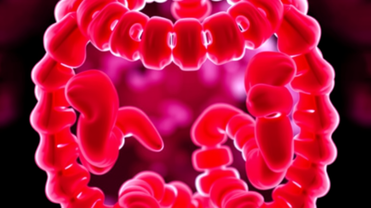 Dual Immunotherapy Edges Out Pembrolizumab in Cost-Effectiveness for MSI-High Colorectal Cancer