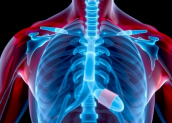 Low Muscle Mass Emerges as a Powerful Predictor of Death in Cancer Patients