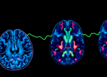 Lost Epigenetic Guardian CBX7 Emerges as Key Driver and Drug Target in Glioblastoma