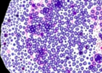 Browser-Based TMA-Grid Tool Brings FAIR, Zero-Footprint De-Arraying to Digital Pathology
