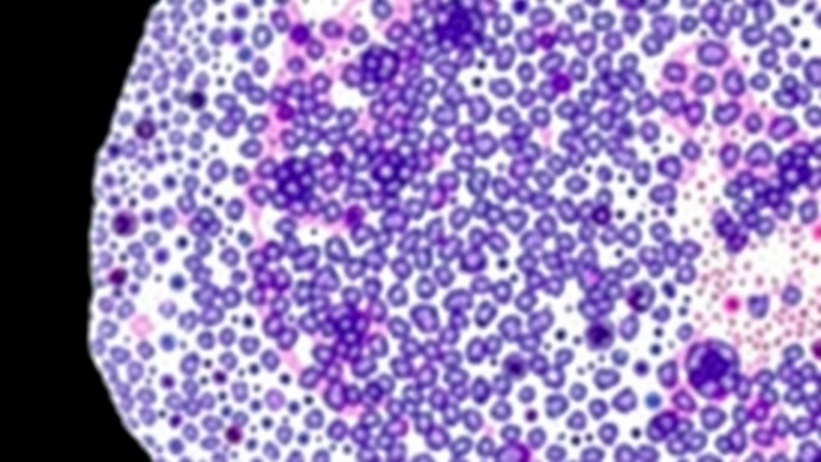 Browser-Based TMA-Grid Tool Brings FAIR, Zero-Footprint De-Arraying to Digital Pathology