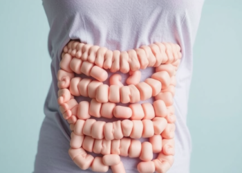 Thyroid Drug’s Rare Side Effect Triggered Sepsis and a Bowel Emergency in a 36-Year-Old Woman