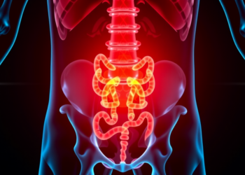 Chemoradiotherapy May Unlock Immunotherapy in Hard-to-Treat Rectal Cancer