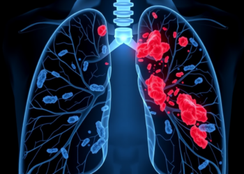 Pigeon-Linked Pneumonia Case Reveals Hidden Double Infection Diagnosed by Sequencing