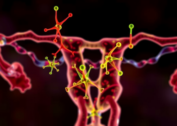 Immune Checkpoint BTLA Emerges as Surprising Prognostic Marker in Ovarian Cancer