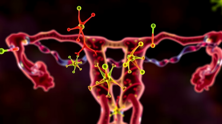 Immune Checkpoint BTLA Emerges as Surprising Prognostic Marker in Ovarian Cancer