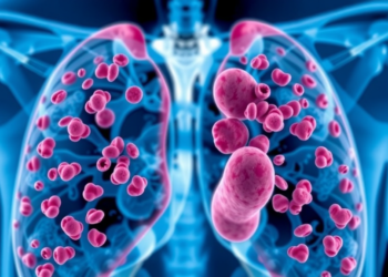 Blood Proteins Before Surgery Reveal Which Prostate Cancers Will Return