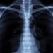 Ovarian Cancer Returns as a Rare Breast Tumor in a Puzzling Case