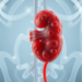 Sluggish Blood Flow May Tear Down the Kidney’s Slippery Sugar Shield in Nephrotic Syndrome